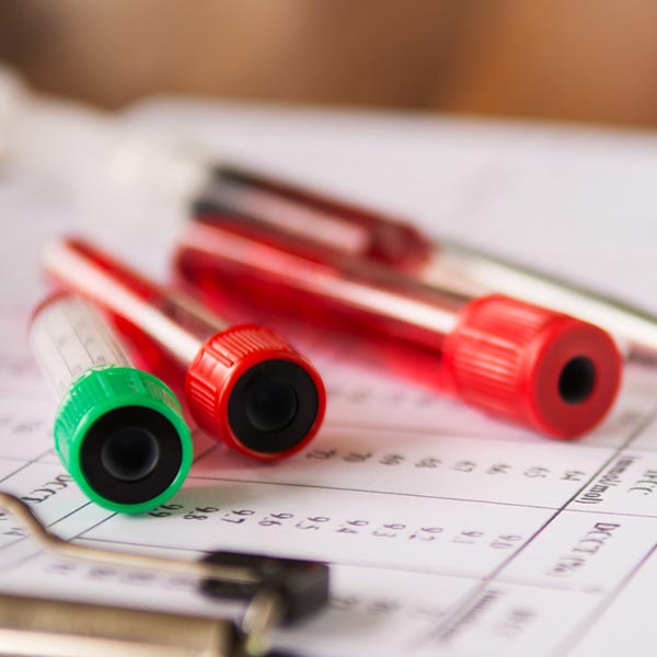 average blood glucose and the hba1c test